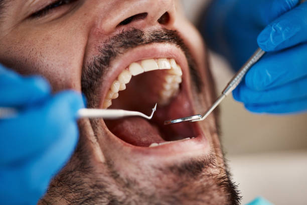 Best Emergency Root Canal Therapy in Comanche, OK